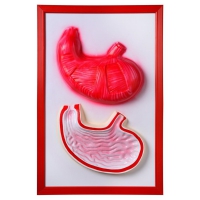 Барельефная модель "Желудок" - «globural.ru» - Чайковский