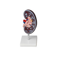 Модель почки в разрезе - «globural.ru» - Чайковский