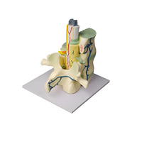 Модель части позвоночника человека - «globural.ru» - Чайковский