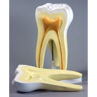 Модель "Строение зуба" - «globural.ru» - Чайковский