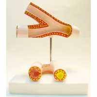 Модель "Здоровые и поврежденные сосуды"	 - «globural.ru» - Чайковский