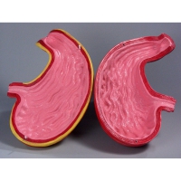 Модель Желудок в разрезе - «globural.ru» - Чайковский