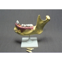 Модель "Челюсть разборная" - «globural.ru» - Чайковский