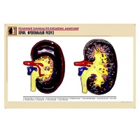Рельефная таблица "Почка. Фронтальный разрез" (формат А1, матовое ламинир.) - «globural.ru» - Чайковский